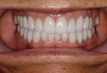 Konig Center for Cosmetic & Comprehensive Dentistry smile photos
